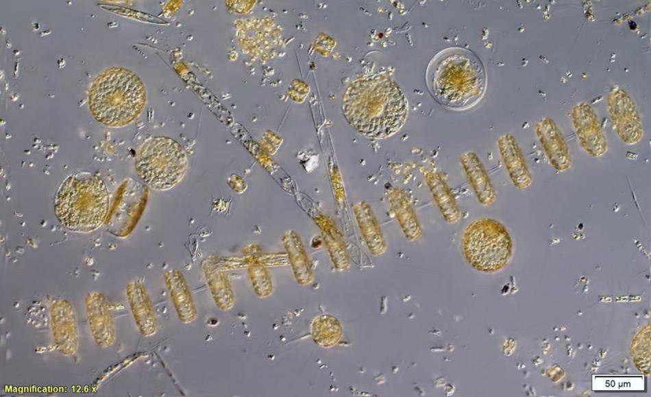 Die Phytoplankton Zellen wurden unter dem Mikroskop vergrößert. (Bild: Alyce Hancock)